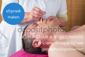 Afspraak maken acupunctuur